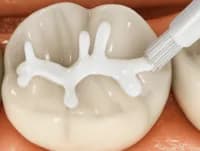 герметизация