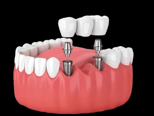 Здоровая улыбка и уход за полостью рта