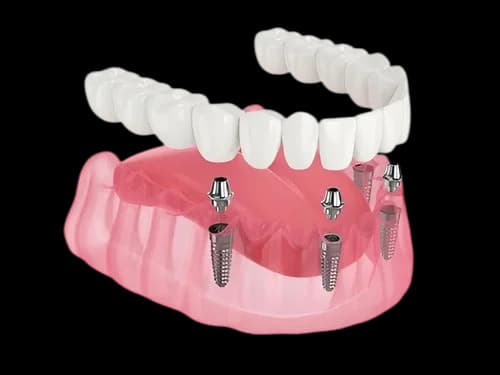 всё на четырёх