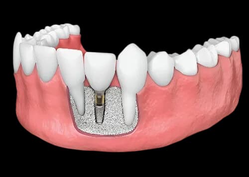 Здоровая улыбка и уход за полостью рта