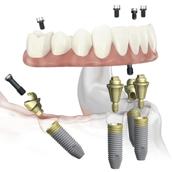 система всё на четырёх
