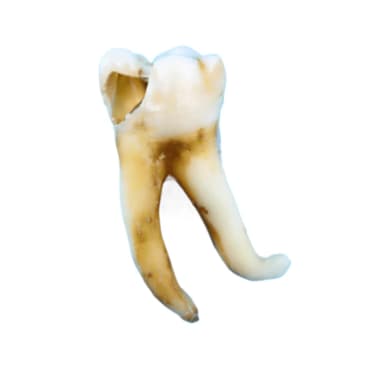 анатомия корней