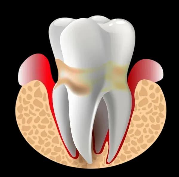 Здоровая улыбка и уход за полостью рта
