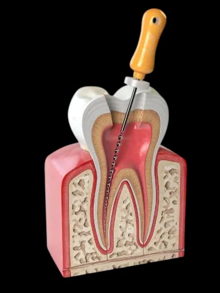 Здоровая улыбка и уход за полостью рта