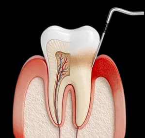 Здоровая улыбка и уход за полостью рта