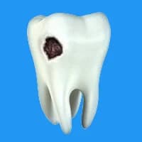 Боль и дискомфорт при жевании