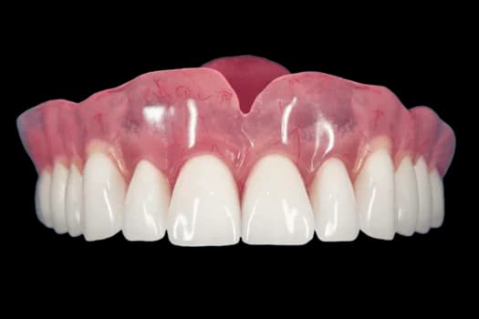 Acry-Free протез