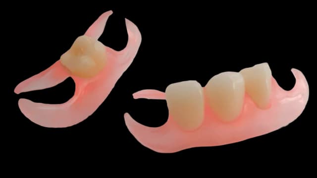 частичный протез бабочка