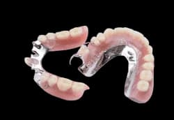 Бюгельный протез — пример съёмной конструкции на опорных зубах