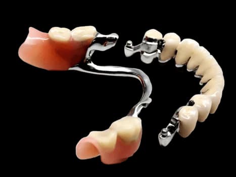 Бюгельный протез на аттачментах