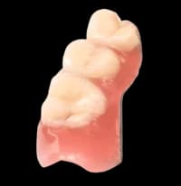 Частичное протезирование зубов