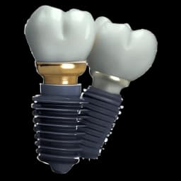 Имплант с коронкой