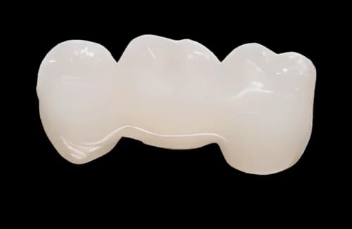 Мостовидный протез