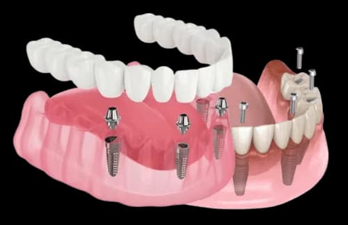 Здоровая улыбка и уход за полостью рта