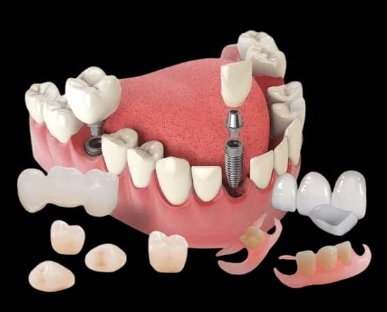 Здоровая улыбка и уход за полостью рта