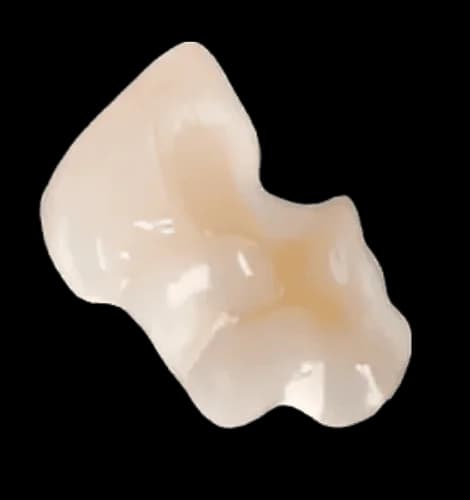 Вкладка Inlay